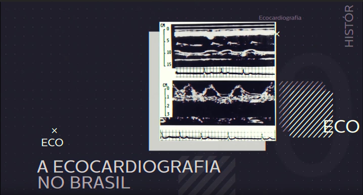 História da Ecocardiografia