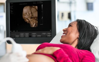 woman getting an ultrasound