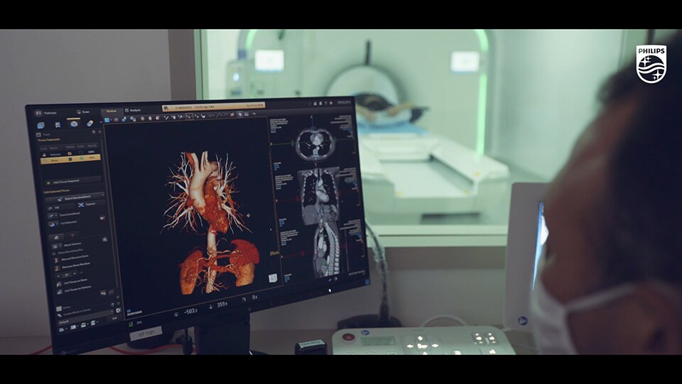Incisive CT
