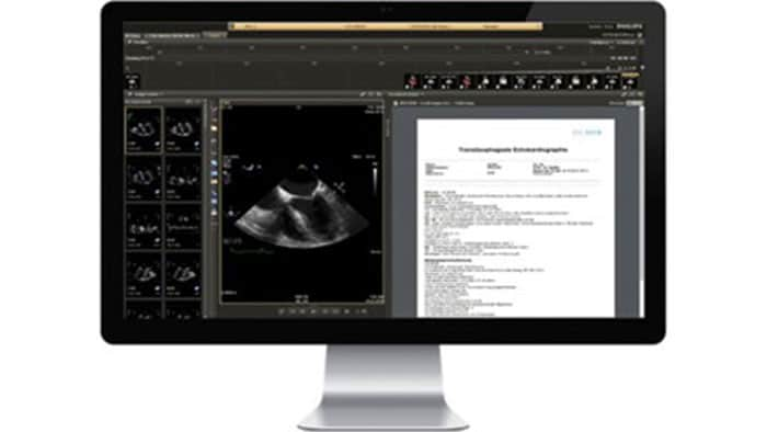 Miniatura da tela IntelliSpace Cardiovascular+