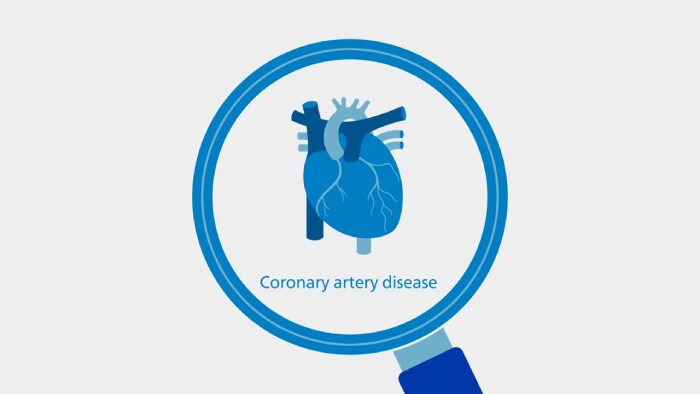 Soluções integradas em todo o ciclo de atendimento da doença arterial coronariana