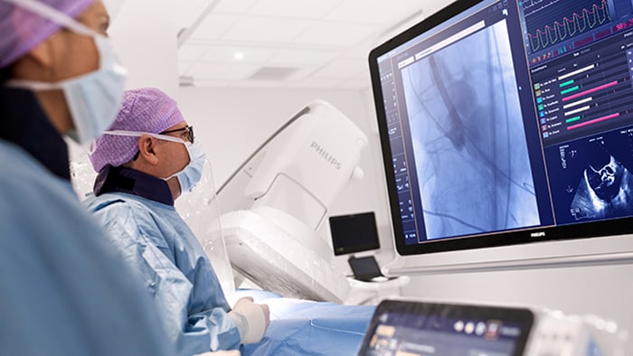 Cardiologista intervencionista trata paciente em móvel Azurion Suite