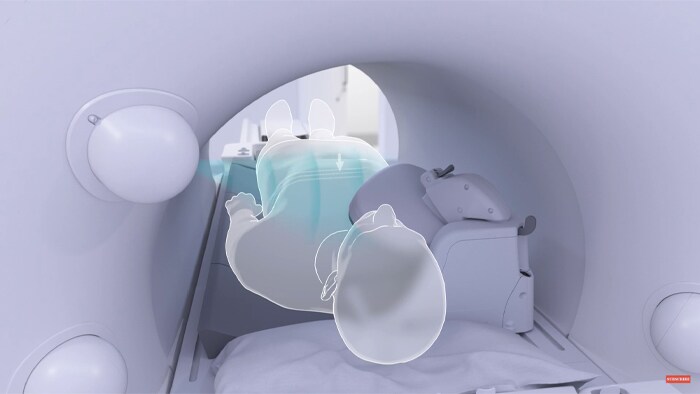 Vídeo postado no YouTube da Philips MR SmartWorkflow em ação