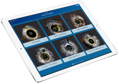 iPad de um especialista em IVUS