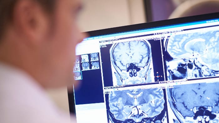 Protocolos da UVM para exames do cérebro atualizados com os métodos mais recentes