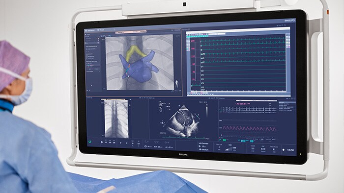 Procedimentos de fibrilação atrial