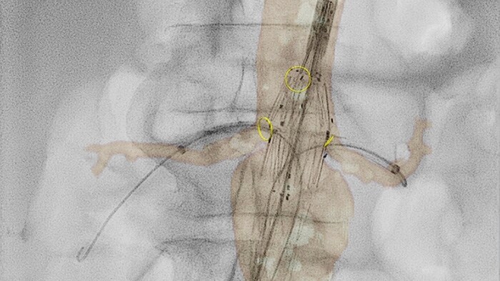 Perfusão vascular 2D