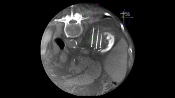 Imagem 3D de CBCT usando Dual View