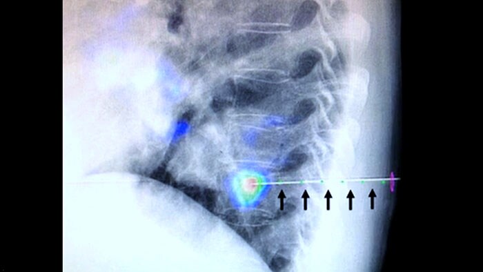 XperGuide e CBCT