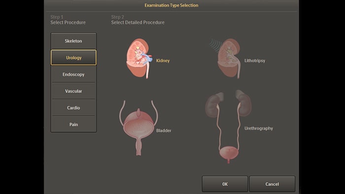 Configurações anatômicas padrão para procedimentos de urologia e endoscopia