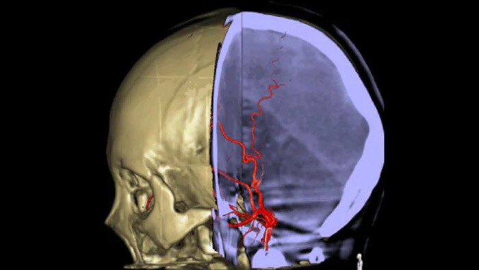 Navegação 3D precisa do Roteiro SmartCT