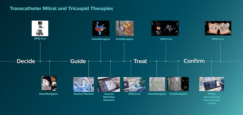 Terapias transcateter das válvulas mitral e tricúspide