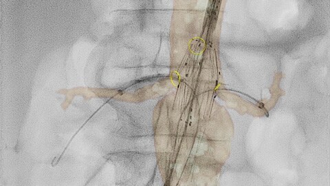 Fluxo de trabalho de radiologia flexível