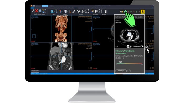 Ecrã da interface de análise clínica num monitor