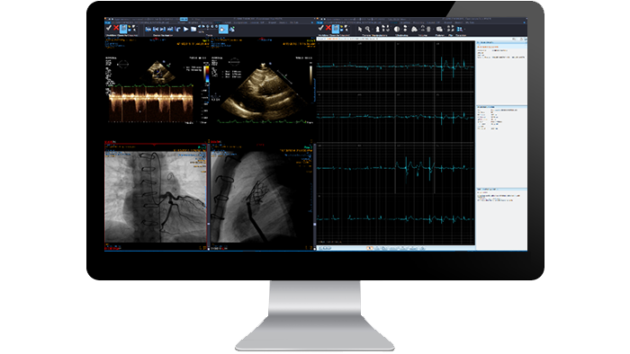 Ecrã da interface do módulo de cardiologia num monitor