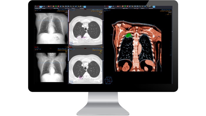 Ecrã da interface do módulo de diagnóstico de radiologia num monitor