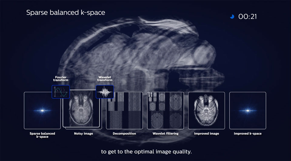 Philips Compressed SENSE - how does it work?