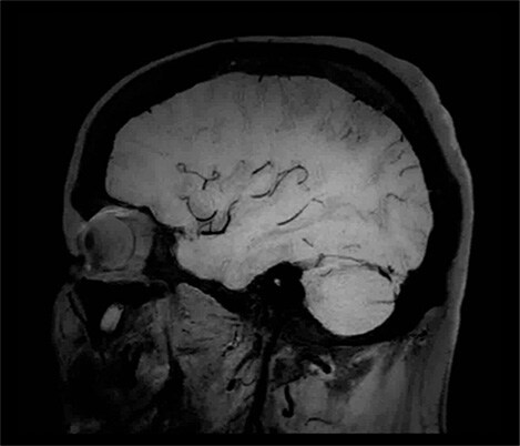Imagens em vídeo do diagnóstico por imagem com técnica de sangue escuro