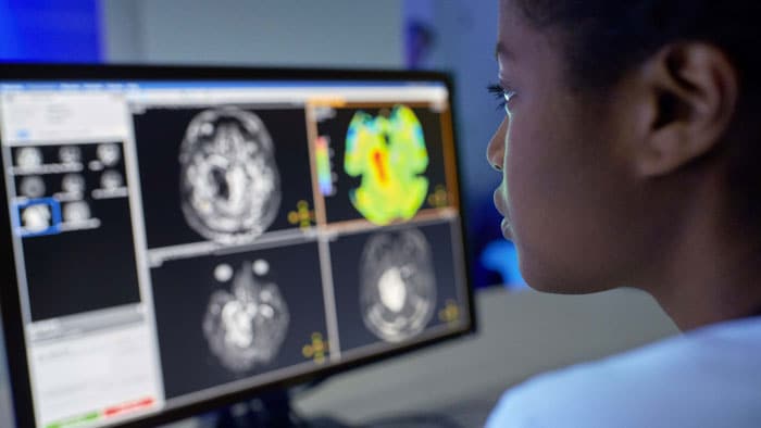 Aplicações em diagnóstico por imagem de estudos cerebrais 