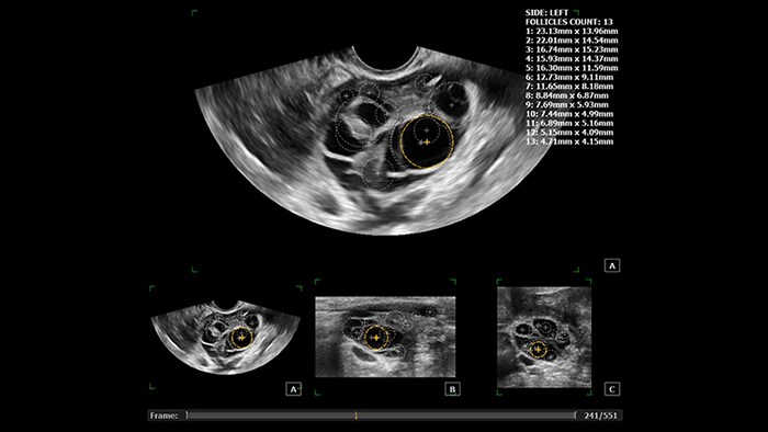 Diagnóstico por imagem de ultrassom