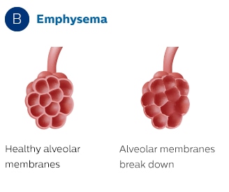 Membranas alveolares