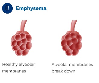 Membranas alveolares