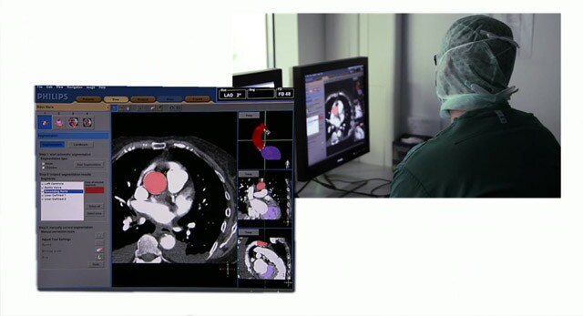 Os médicos compartilham experiências com o HeartNavigator Philips 