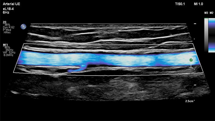 microflow imaging