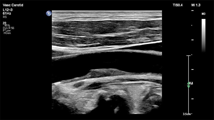 confiança no diagnóstico durante imagiologia vascular