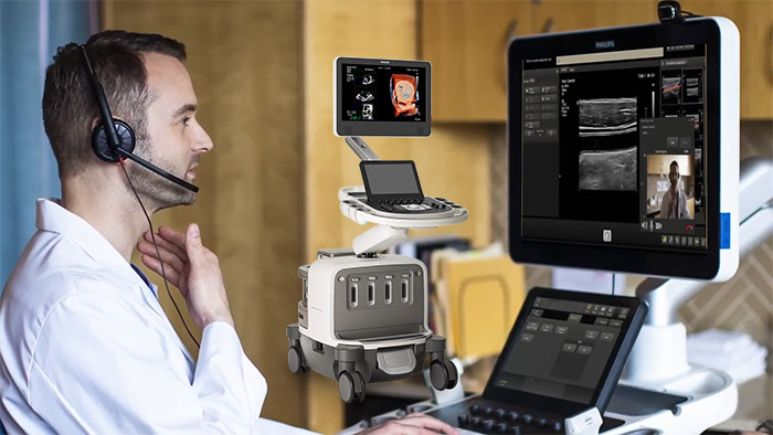 tele ultrasound collaboration live