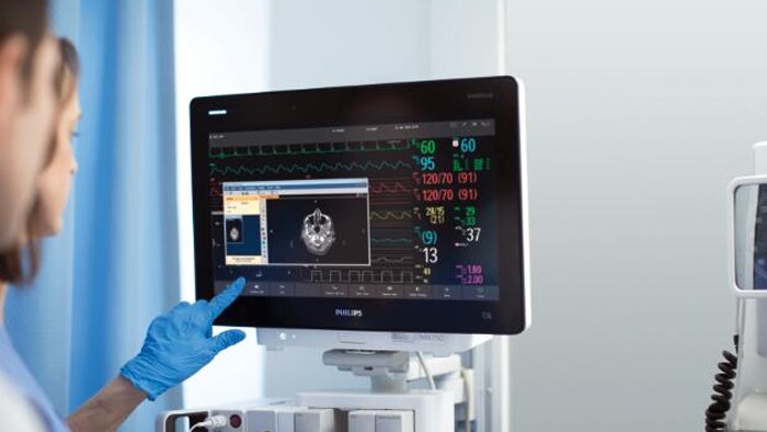 MX750 at the ICU