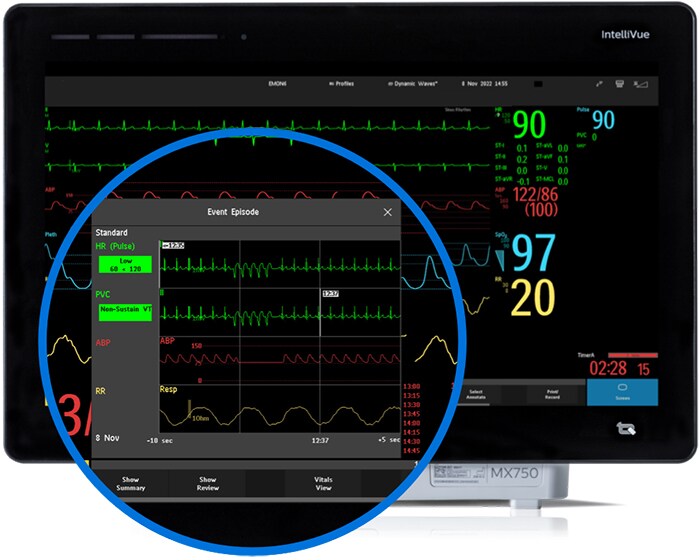 Advanced Event Surveillance Monitor em desktops