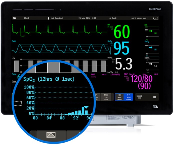 Monitoramento do histograma e da resposta dos pacientes em deskpots