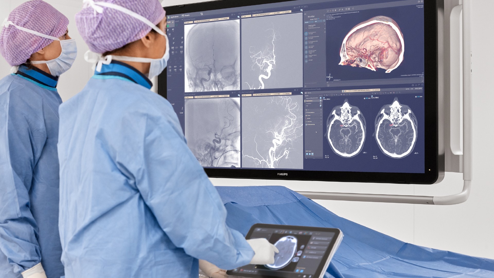 Tempo é cérebro: novas tecnologias usam IA para ajudar casos de AVC