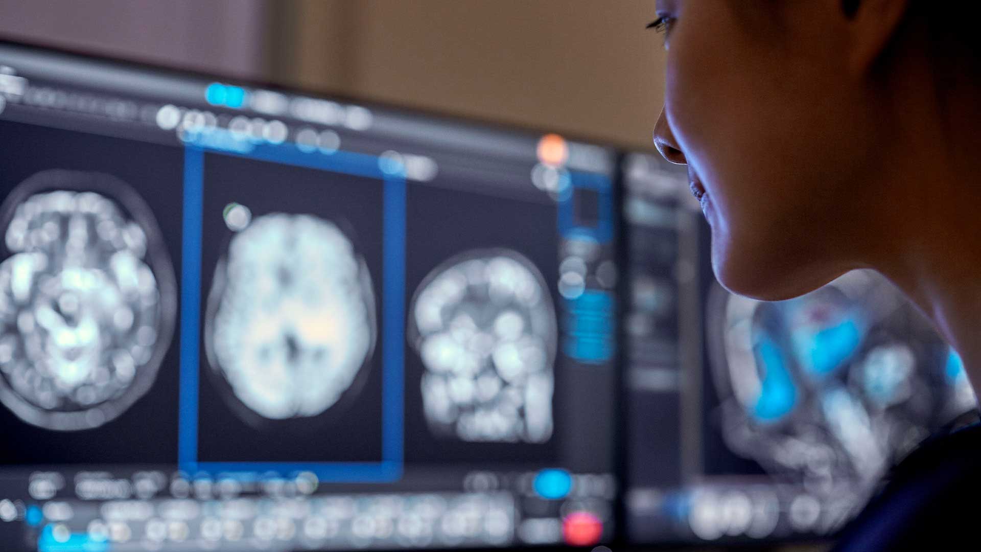 Philips lança inovações habilitadas para IA na #RSNA23 que liberam os profissionais de saúde para se concentrarem no atendimento ao paciente