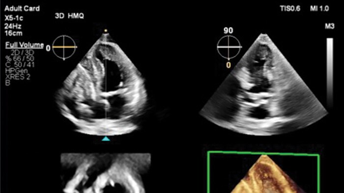 EPIQ CVx system clinical view