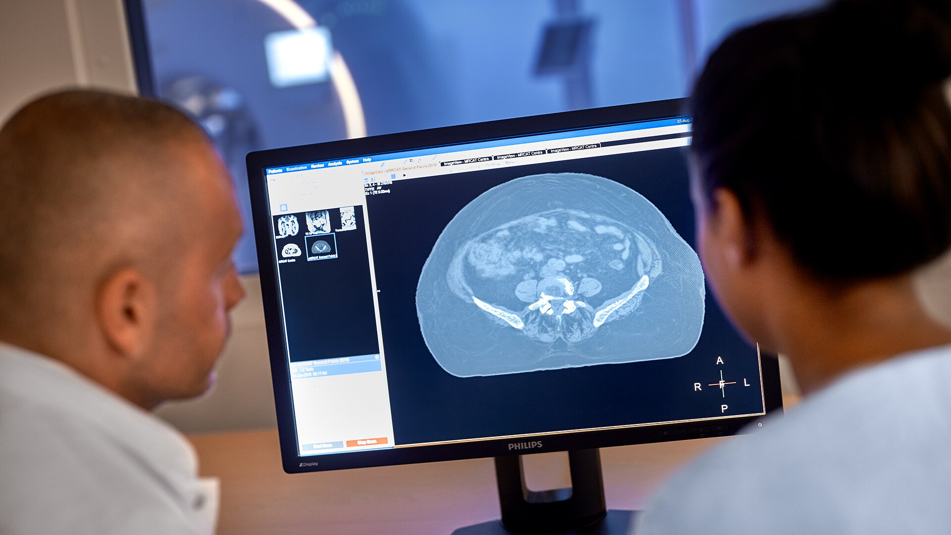 Philips investe em tecnologia e conectividade para integrar os fluxos de trabalho em radiologia e acelerar o caminho do diagnóstico preciso